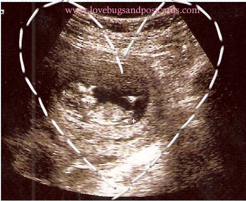baby4